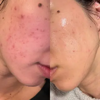 beauty salon mimo所属・かわなべ なつきのエステ・リラクイメージ