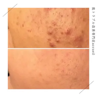 セミロング カラー パーマ ヘアアレンジ メンズ キッズ ネイル マツエク・マツパ アイブロウ 触れたくなる モテ肌へ...❤︎のエステ・リラクイメージ