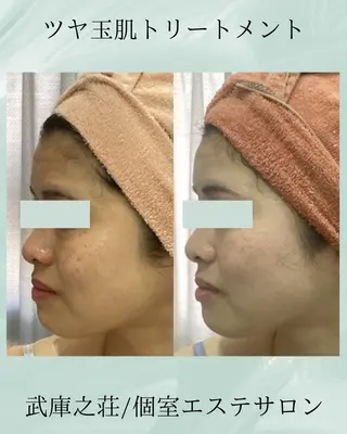 エステ♡Eden Asamiのエステ・リラクイメージ