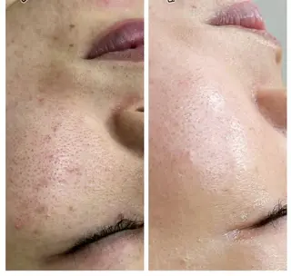 バスト＆フェイシャル RAYVIS 野地のエステ・リラクイメージ