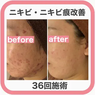 ミディアム カラー パーマ ヘアアレンジ メンズ キッズ ネイル マツエク・マツパ ニキビ・肌質改善専門 ♡人生が変わるサロンのエステ・リラクイメージ