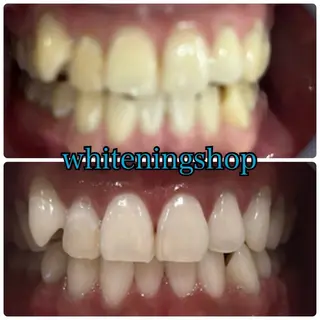 メンズ ホワイトニング ショップ川越店のエステ・リラクイメージ