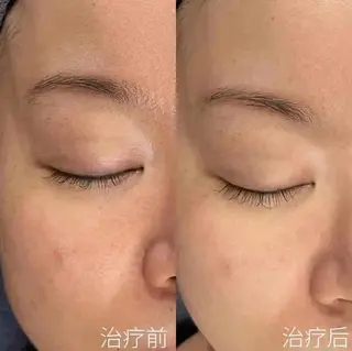 マツエク・マツパ aliaハイフ&水光ジェットサロン所属・aliaハーブ水光店 エステティシャン募集のエステ・リラクイメージ