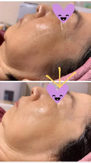 Lien オーナー　山口智嘉のエステ・リラクイメージ