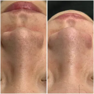 re.make所属・小顔美肌💖痩身☃️ ユキナ🤍のエステ・リラクイメージ