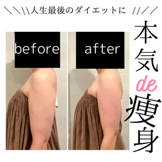 小顔・リフトアップ/ 奈緒美のエステ・リラクイメージ