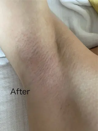 une所属・une シュガーリング脱毛のエステ・リラクイメージ