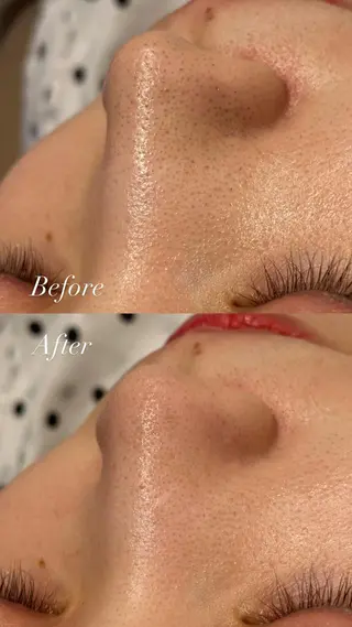 Lilyboo 多田のエステ・リラクイメージ