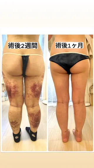 メディカル インディバサロン同心のエステ・リラクイメージ