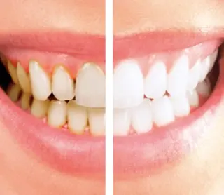 Totalbeautysalon Coco所属・Coco caoriのマツエク・マツパデザイン