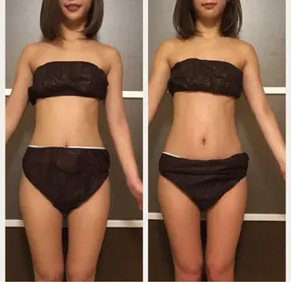 ショート カラー パーマ ヘアアレンジ メンズ キッズ ネイル マツエク・マツパ アニメ,Vオタク× 即効痩せエステサロンのエステ・リラクイメージ