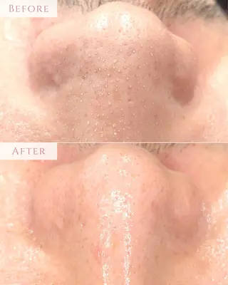 肌質改善専門サロン Bellmi/心斎橋のエステ・リラクイメージ