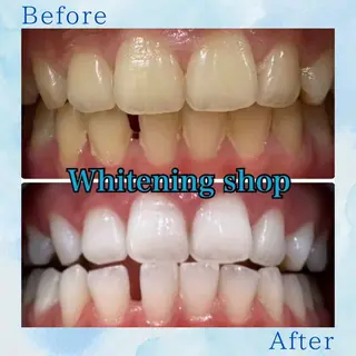 ホワイトニング ショップ葛西店のその他イメージ