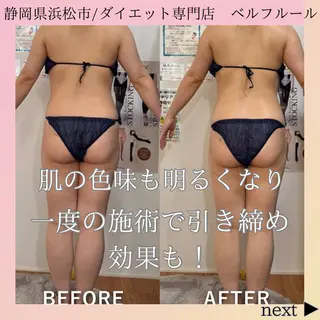 ベルフルール所属・鈴木 悠佳梨のエステ・リラクイメージ