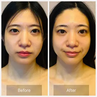 美肌エイジングケアサロンIB所属・ＩＢ 内藤のエステ・リラクイメージ