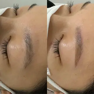 アイブロウ Amaranth所属・Lupinus 小顔矯正のエステ・リラクイメージ