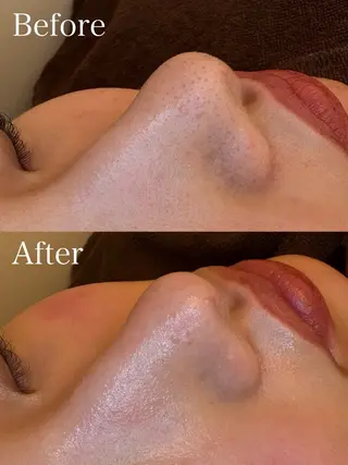 EARTH coiffure beaute 新潟紫竹山店所属・🤍アベシュリ /フェイシャル🤍のエステ・リラクイメージ