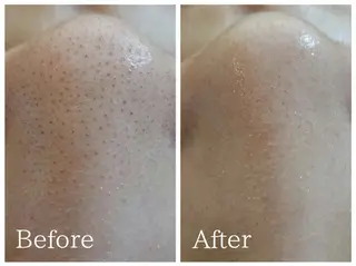 LUCE keiのエステ・リラクイメージ