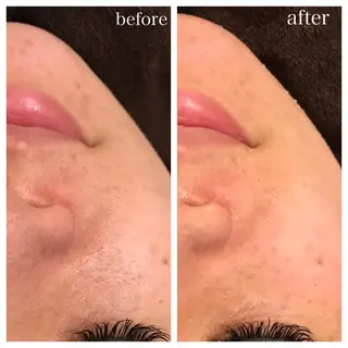 セミロング ネイル マツエク・マツパ ニキビ跡専門サロン Ａｉｎａのエステ・リラクイメージ