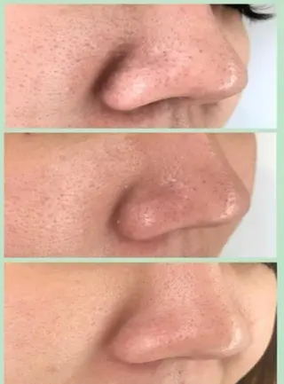 POLA   Avan Mu所属・下谷 葵のエステ・リラクイメージ