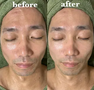 メンズ 【肌質改善サロン】 リーフィアのエステ・リラクイメージ