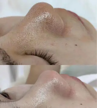 愛維美水光美肌専門店所属・愛維美水光美肌専門店 メンズレディースokのエステ・リラクイメージ