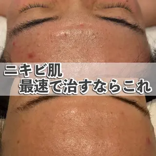 SHELLY 矢野のマツエク・マツパデザイン