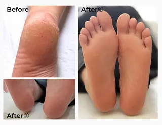 ネイル IRIS-アイリス- Nomu.のネイルデザイン