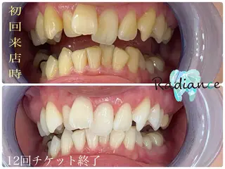 札幌ホワイトニング ラディアンス札幌駅店のその他イメージ