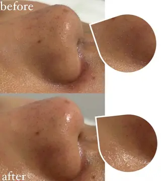 女性専門お顔剃り sunraineのエステ・リラクイメージ