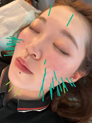 小顔美容鍼専門サロン 渋谷YZのその他イメージ