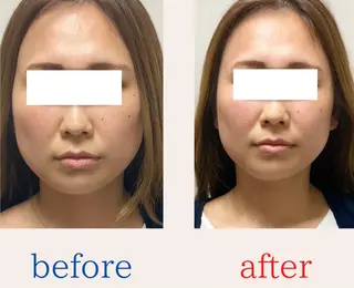 BEAUTY&HEALTH鍼灸院【春日部筋膜整体タケダ整体院】所属・武田 紘輝のエステ・リラクイメージ