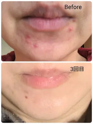 ECLAT所属・プライベートサロン✢ Eclatエクラ　のエステ・リラクイメージ