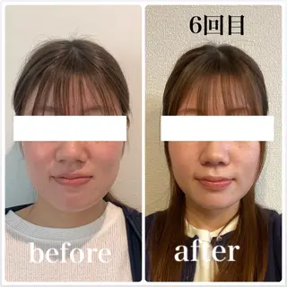 小顔と ヘッドスパのお店のエステ・リラクイメージ