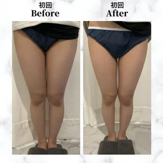 12Dハイフ💗 最強小顔のエステ・リラクイメージ