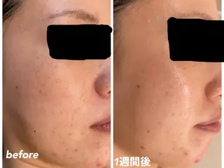 ビューティサロン aiwaのエステ・リラクイメージ