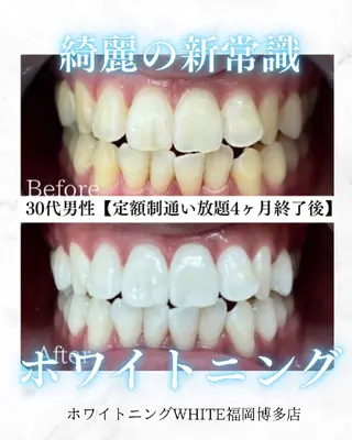 メンズ キッズ セルフホワイトニング WHITE福岡博多店のエステ・リラクイメージ