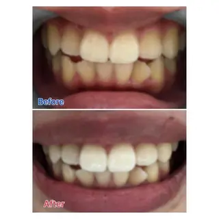 M渋谷店所属・M渋谷 ホワイトニングのエステ・リラクイメージ