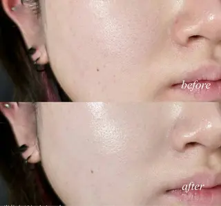 愛維美水光美肌専門店所属・愛維美水光美肌専門店 メンズレディースokのエステ・リラクイメージ