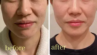 小顔×肌質改善サロン soin〔ソワン〕のエステ・リラクイメージ