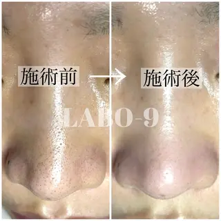 LABO-9所属・田中 捺未のエステ・リラクイメージ