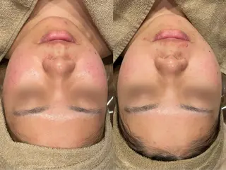 Re:Belle所属・Re:Belle 久留米 : 中島のエステ・リラクイメージ