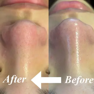 まつげ美人所属・毛穴 専門店のエステ・リラクイメージ