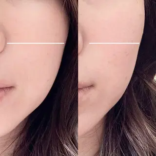 Balance facialのエステ・リラクイメージ