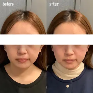 エステサロンino.colore'所属・小顔サロン ino.coloreのエステ・リラクイメージ