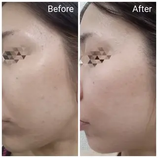 肌質改善Beauty salon Renのエステ・リラクイメージ