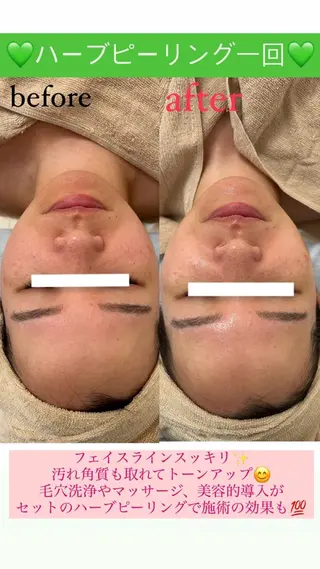 Salon de Lino 御器所のエステ・リラクイメージ