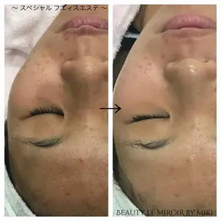 ビューティー ミロワールのエステ・リラクイメージ