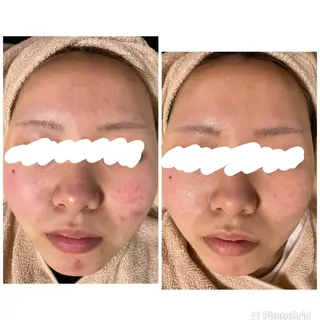 ミディアム カラー パーマ ヘアアレンジ メンズ ネイル マツエク・マツパ アイブロウ ニキビ&跡改善サロン オーナー光木のエステ・リラクイメージ