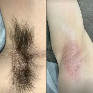 六本木脱毛andS さおりのエステ・リラクイメージ